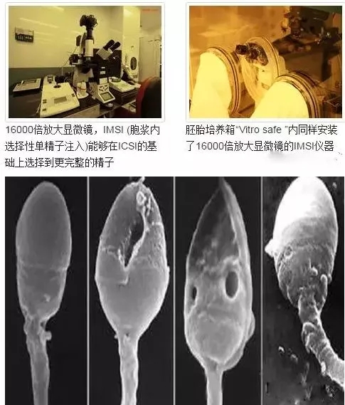 16000高倍显微镜下优选精子形态技术(IMSI)