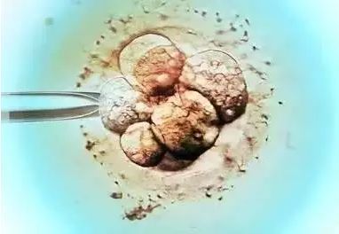 美国试管婴儿：优质胚胎是如何筛选出来的？