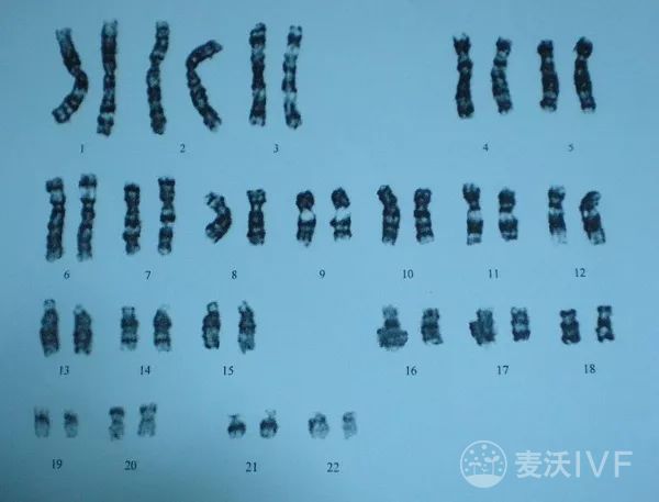 地中海贫血不可治疗但可预防