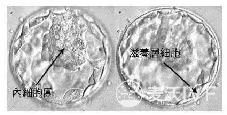 台湾试管婴儿：如何避免试管婴儿中多胎妊娠的风险