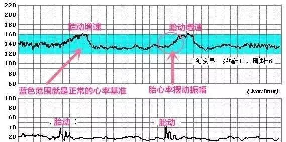 怀孕后几周开始做胎心监护？教你怎么看胎心监护曲线图