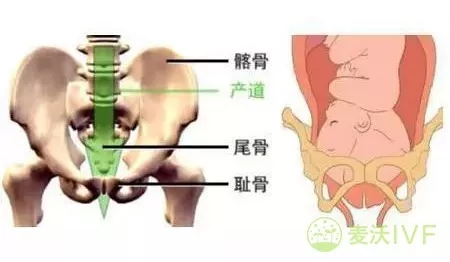 俄罗斯试管婴儿：如果您有这5种情况，基本与顺产无缘！