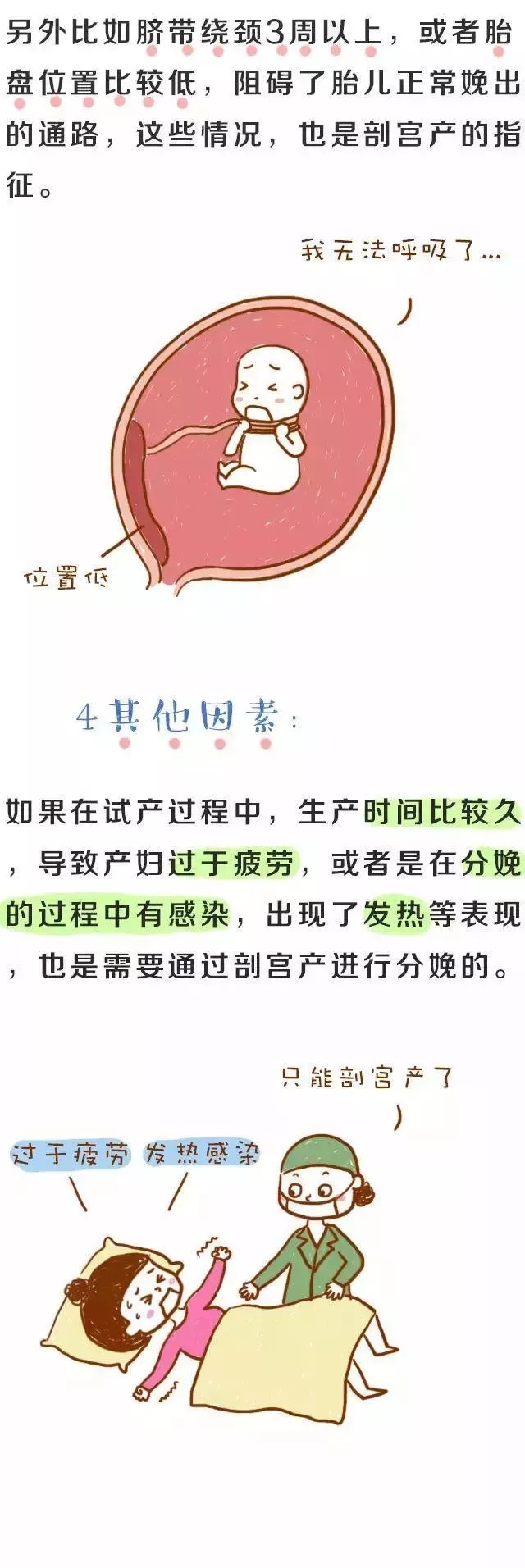 顺还是剖？这四种情况情况下只能剖不能顺！