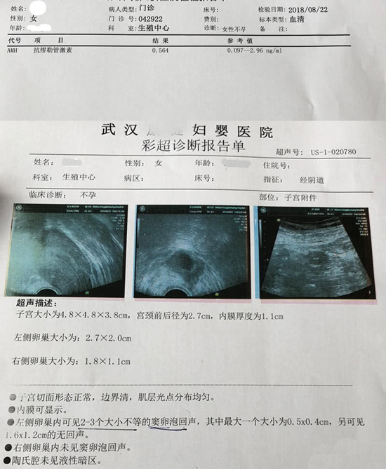 爱之晶海外试管名称解释——AMH