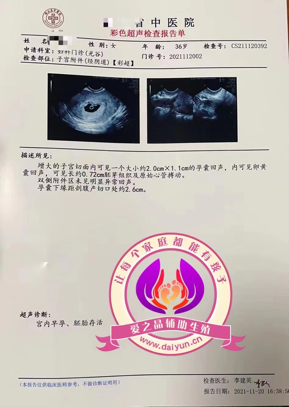 恭喜武汉客户怀孕一个月成功检查胎心