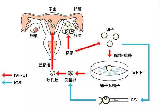 试管助孕_2