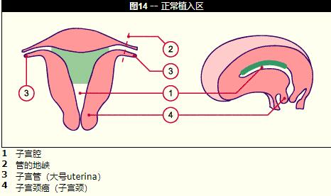 第三代试管婴儿_1