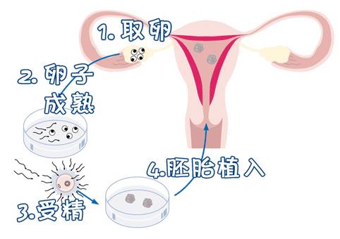 泰国试管_1
