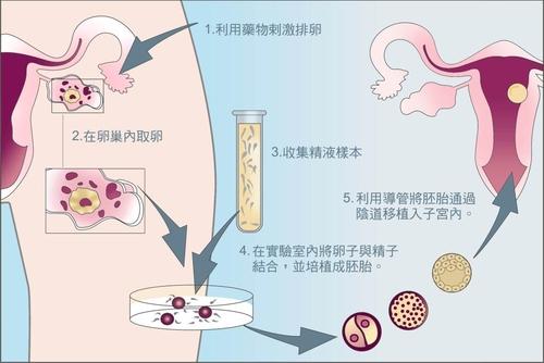 泰国试管_3