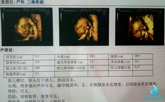 第三代试管婴儿_3