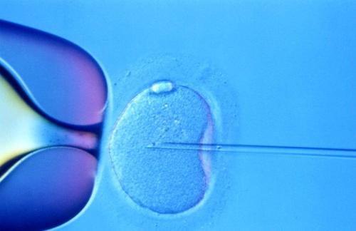 台湾体外受精卵子捐赠过程描述