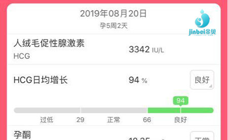 试管婴儿_1