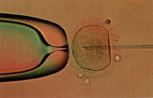 胚胎-掏心窝讲：选择试管生殖中心别单单找***“**”的