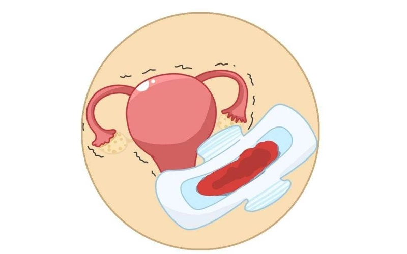 宫颈癌发出的第一信号经常在月经