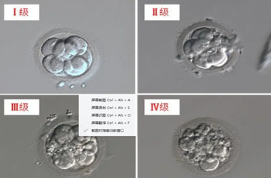 爱之晶：那么试管养囊的标准是什么？